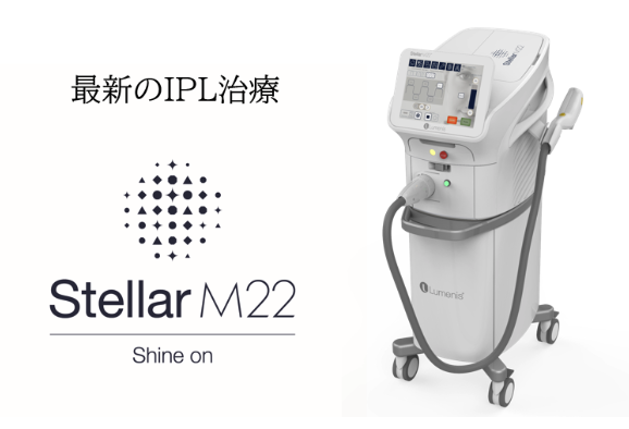 Stellar M22